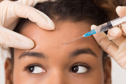 What You Should Know Before Getting Botox
