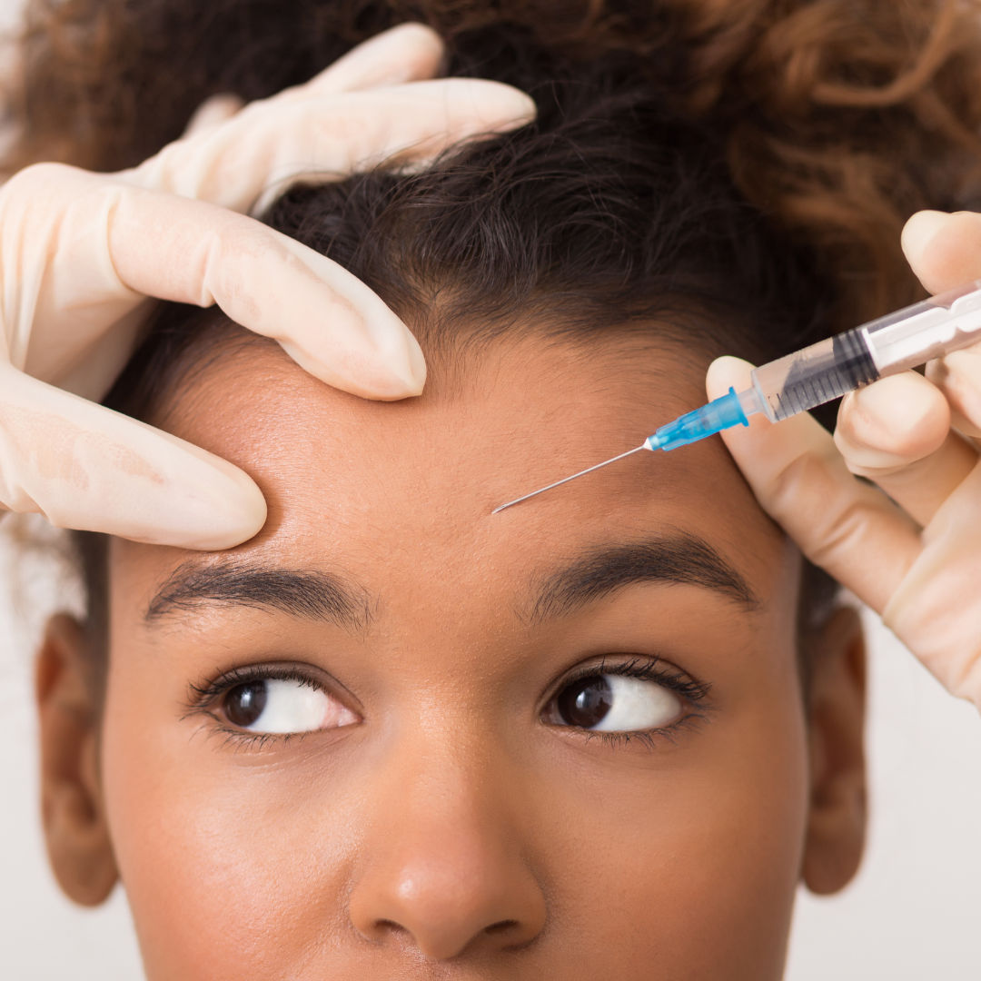 What You Should Know Before Getting Botox