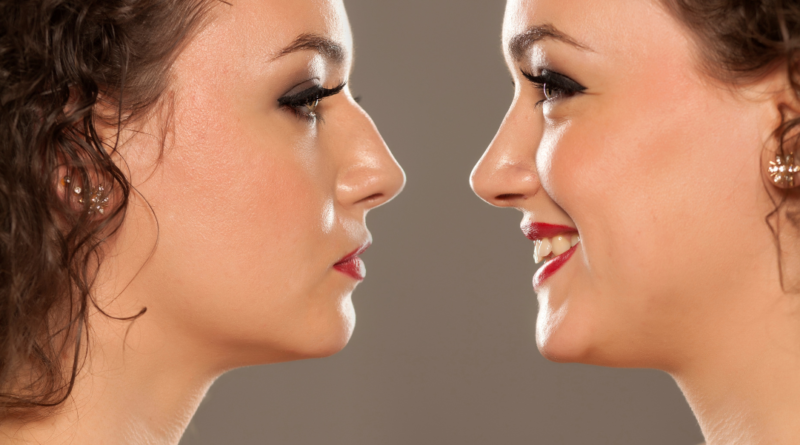 Everything You Need to Know About the Rhinoplasty & Nose Reshaping?
