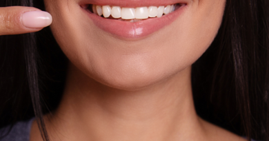 Helpful Tips for Keeping Your Teeth White