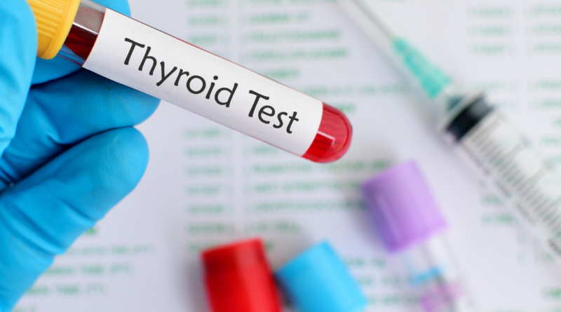 Thyroid Basics: Issues and Health Tips