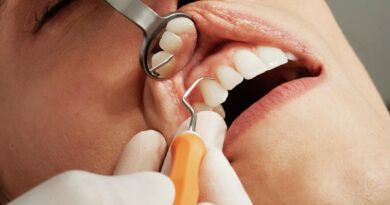 Replacing missing teeth with dental implants
